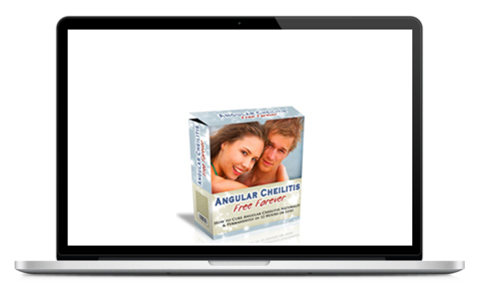 Angular Cheilitis Free Forever Review 2023